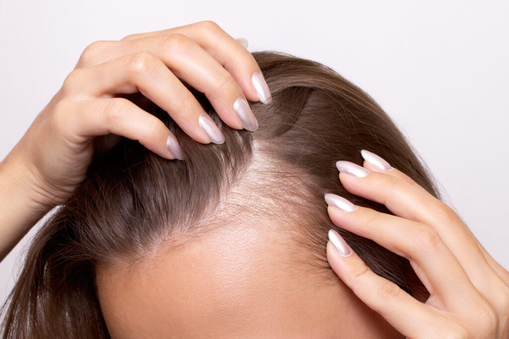 Other FAQs about Scalp Microneedling