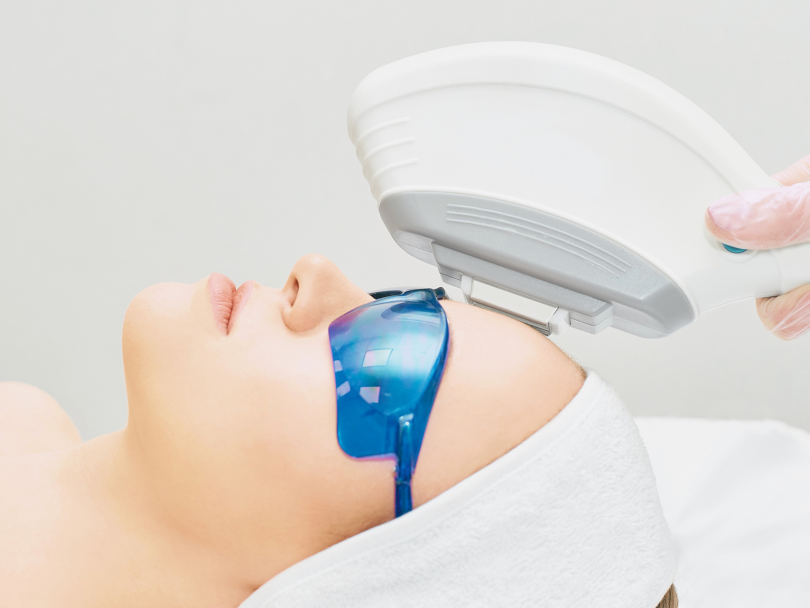 IPLskin rejuvenation before botox