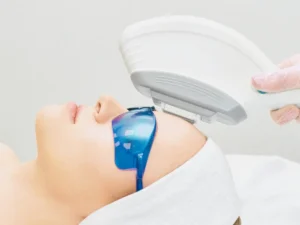 IPL Facial — therapist performing an IPL facial on a client